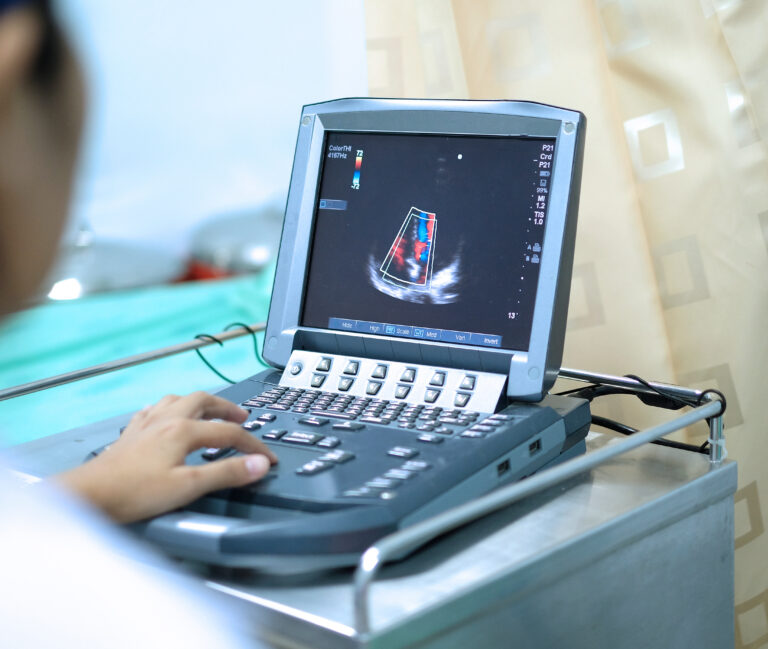 Ultrasound Venous Duplex Scanning: The Foundation of Effective Vein Treatment￼